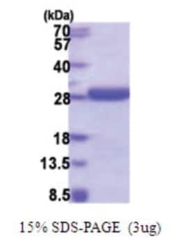 Novus Biologicals Recombinant Human HD domain containing 2 His Protein 0,1 mg | Buy Online | Novus Biologicals&trade; | Fisher Scientific