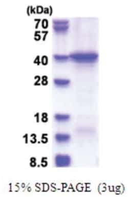 Novus Biologicals Recombinant Human HERC5 His Protein 0.1 mg | Buy Online | Novus Biologicals&trade; | Fisher Scientific