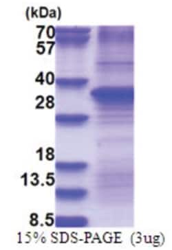 Novus Biologicals Recombinant Human HGF His Protein 0.5 mg | Buy Online | Novus Biologicals&trade; | Fisher Scientific
