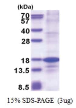 Novus Biologicals&trade;&nbsp;Recombinant Human Histone H2A.Z His Protein