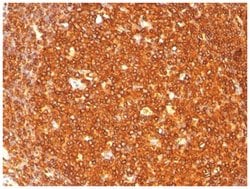 HLA-DR Antibody (LN-3) - Azide and BSA Free, Novus Biologicals 0.2mg; Unlabeled:Antibodies,