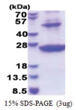 Novus Biologicals&trade;&nbsp;Recombinant Human HLA DRB1 His Protein