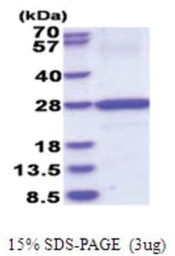 Novus Biologicals&trade;&nbsp;Recombinant Human HLA DOB His Protein