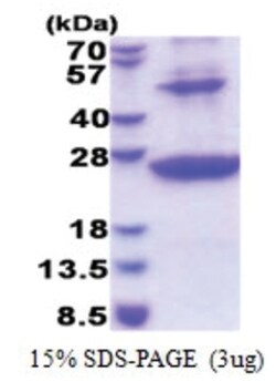 Novus Biologicals Recombinant Human HLA DRB1 His Protein 0.5 mg | Buy Online | Novus Biologicals&trade; | Fisher Scientific