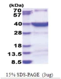 Novus Biologicals Recombinant Human HSF2BP His Protein 0.1 mg | Buy Online | Novus Biologicals&trade; | Fisher Scientific