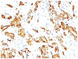 HSP27 Mouse, Clone: G3.1, Novus Biologicals:Antibodies:Primary Antibodies