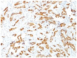 HSP27 Mouse, Clone: G3.1, Novus Biologicals:Antibodies:Primary Antibodies