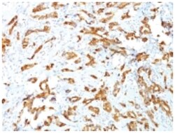 HSP27 Mouse, Clone: G3.1, Novus Biologicals:Antibodies:Primary Antibodies