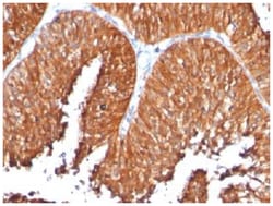 HSP60 Mouse, Clone: SPM253, Novus Biologicals 0.02mg; Unlabeled:Antibodies,