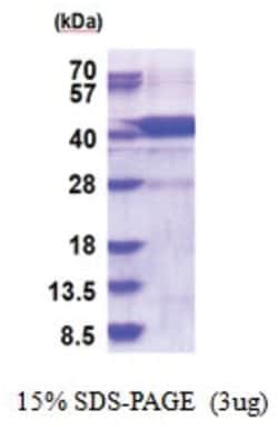 Novus Biologicals&trade;&nbsp;Recombinant Human Hydroxylysine kinase His Protein