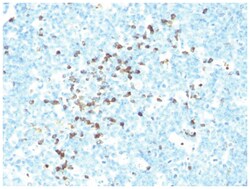Lambda Light Chain Antibody (LcN-2 + ICO-106), Novus Biologicals:Antibodies:Primary