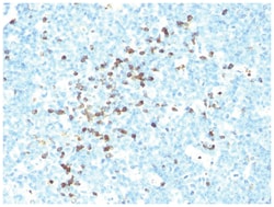 IgM Antibody (DA4-4 (same as SA-DA4 or HB57)), Novus Biologicals 0.1mg;