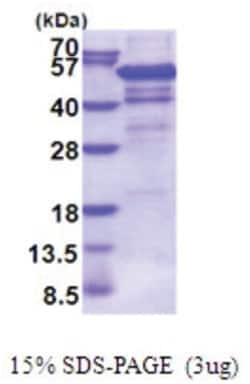 Novus Biologicals&trade;&nbsp;Recombinant Human IHPK2 His Protein