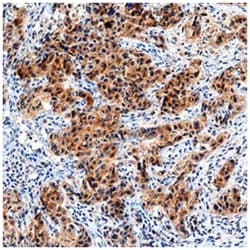 IL-17RB Antibody (938923) - Azide and BSA Free, Novus Biologicals 25&mu;g;