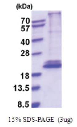 Novus Biologicals&trade;&nbsp;Recombinant Human IL-28B/IFN-lambda 3 His Protein