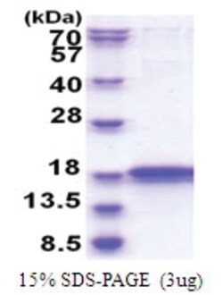 Novus Biologicals Recombinant Human IMMP2L His Protein 0.1 mg | Buy Online | Novus Biologicals&trade; | Fisher Scientific