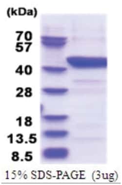 Novus Biologicals Recombinant Human Indoleamine 2,3-dioxygenase/IDO His Protein 0.1 mg | Buy Online | Novus Biologicals&trade; | Fisher Scientific