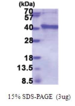 Novus Biologicals Inositol Monophosphatase 3/IMPAD1 Human Recombinant Protein 0.01 mg | Buy Online | Novus Biologicals&trade; | Fisher Scientific
