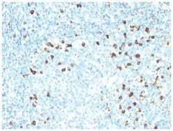 Kappa Light Chain Antibody (KLC264), Novus Biologicals 0.02mg; Unlabeled:Antibodies,