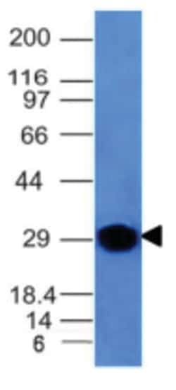 Kappa Light Chain Antibody (KLC264), Novus Biologicals 0.02mg; Unlabeled:Antibodies,