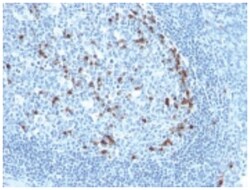 Kappa Light Chain Antibody (KLC709), Novus Biologicals 0.2mg; Unlabeled:Antibodies,