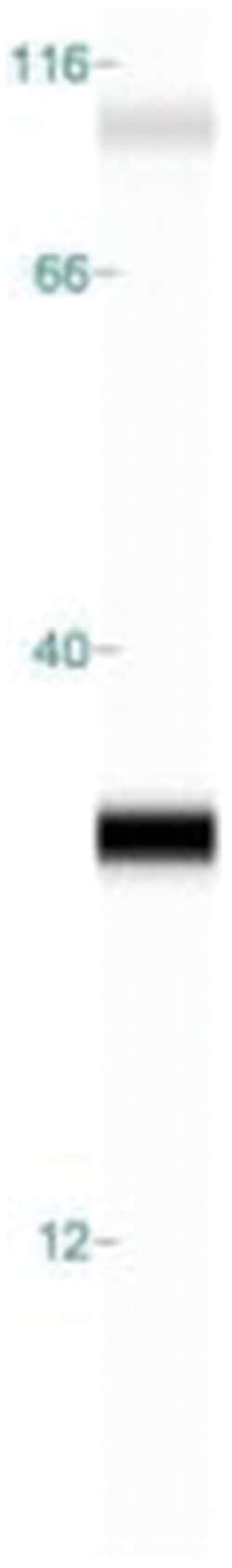 Kappa Light Chain Antibody (KLC709), Novus Biologicals 0.2mg; Unlabeled:Antibodies,