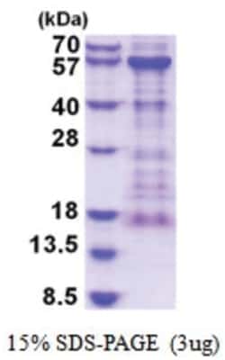 Novus Biologicals&trade;&nbsp;Recombinant Human KIAA0513 His Protein