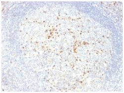 Lambda Light Chain Antibody (LcN-2 + ICO-106), Novus Biologicals:Antibodies:Primary