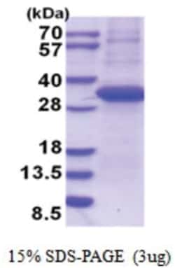 Novus Biologicals&trade;&nbsp;Recombinant Human Langerin/CD207 His Protein
