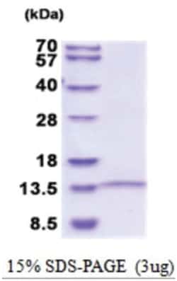 Novus Biologicals&trade;&nbsp;Recombinant Human LINGO-1 His Protein