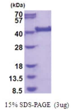 Novus Biologicals&trade;&nbsp;Recombinant Human LRP2BP His Protein