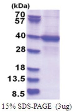 Novus Biologicals&trade;&nbsp;Recombinant Human LYK5 His Protein