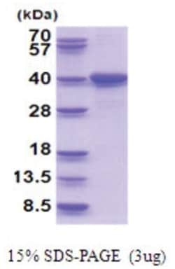 Novus Biologicals&trade;&nbsp;Recombinant Human LZTFL1 His Protein