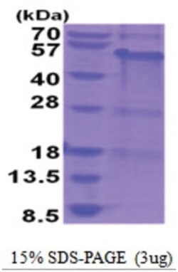 Novus Biologicals&trade;&nbsp;Recombinant Human MAGEA8 His Protein