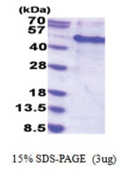 Novus Biologicals&trade;&nbsp;Recombinant Human MAK16 His Protein