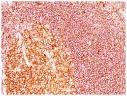 MALT1 Antibody (SPM578), Novus Biologicals 0.2mg; Unlabeled:Antibodies,
