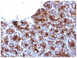 MAML3 Antibody (MAML3/1303), Novus Biologicals:Antibodies:Primary Antibodies