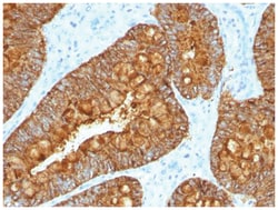 MAML3 Antibody (MAML3/1303), Novus Biologicals:Antibodies:Primary Antibodies
