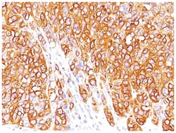 Melan-A/MART-1 Mouse, Clone: SPM342, Novus Biologicals 0.02mg; Unlabeled:Antibodies,