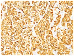 Melan-A/MART-1 Mouse, Clone: SPM342, Novus Biologicals 0.02mg; Unlabeled:Antibodies,