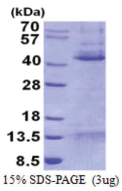 Novus Biologicals™ Recombinant Human Mcl-1 His Protein