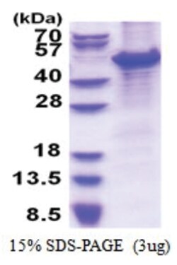 Novus Biologicals&trade;&nbsp;Recombinant Human MCM7 His Protein