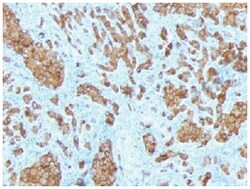 Melan-A/MART-1 Mouse, Clone: SPM342, Novus Biologicals 0.02mg; Unlabeled:Antibodies,