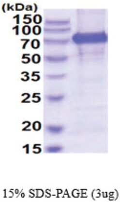 Novus Biologicals Recombinant Human Meprin alpha Subunit/MEP1A His Protein 10 &mu;g | Buy Online | Novus Biologicals&trade; | Fisher Scientific