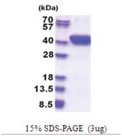 Novus Biologicals Recombinant Human MESDC1 His Protein 0.5 mg | Buy Online | Novus Biologicals&trade; | Fisher Scientific