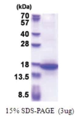 Novus Biologicals&trade;&nbsp;Recombinant Human MFAP3 His Protein