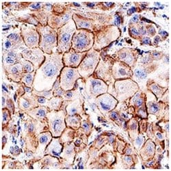 MLKL, p Thr357 Antibody (954724) - Azide and BSA Free, R D Systems 25&mu;g;