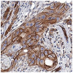 MLKL, p Thr357 Antibody (954724) - Azide and BSA Free, R D Systems 25&mu;g;