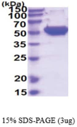 Novus Biologicals&trade;&nbsp;Recombinant Human MMP-1 His Protein