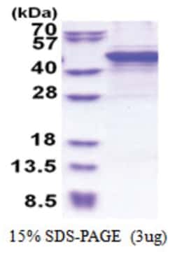 Novus Biologicals Recombinant Human MMP-10 His Protein 0.5 mg | Buy Online | Novus Biologicals&trade; | Fisher Scientific
